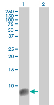 WB - S100A6 Antibody (monoclonal) (M10) AT3759a